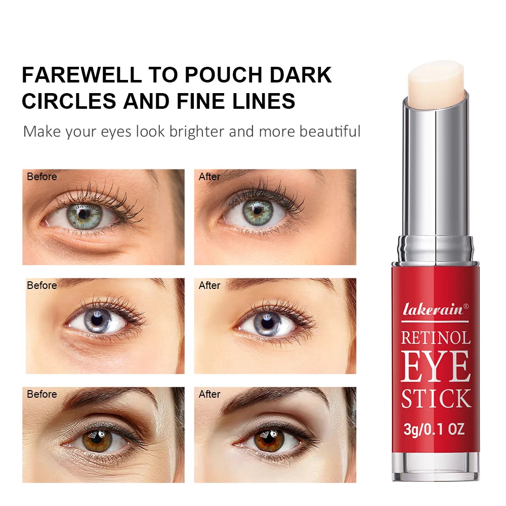 Real-life before and after comparison photos of three different eye areas showing visible reduction in puffiness, dark circles, and fine lines.